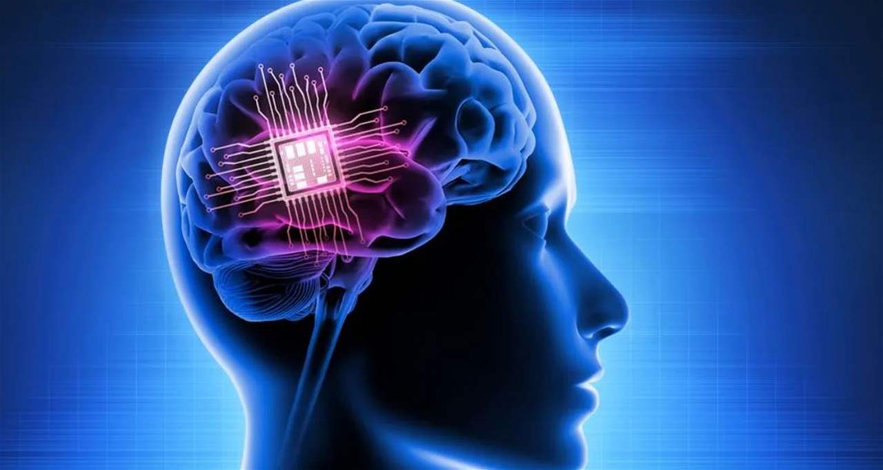 الصين تدخل ميدان زراعة الشرائح الدماغية وتنافس شركة ماسك