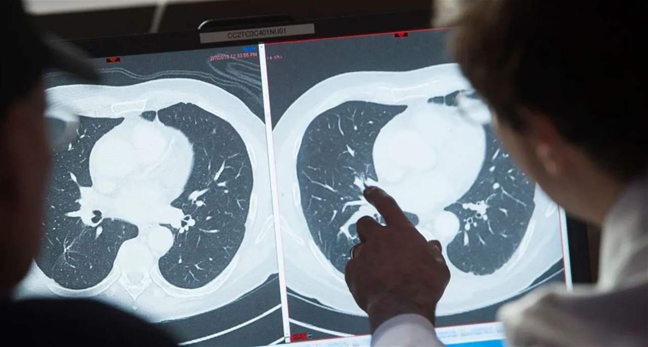   علاج قد يقتل السرطان.. الحل قادم من الفضاء