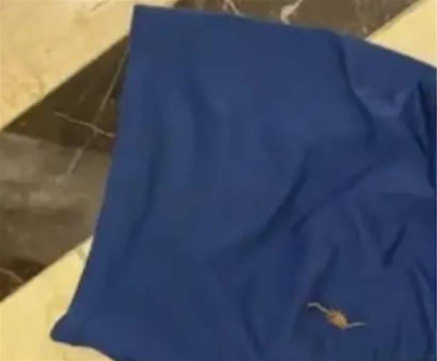عقرب يلدغ نزيلاً في "منطقة حساسة"  أثناء نومه بفندق فاخر
