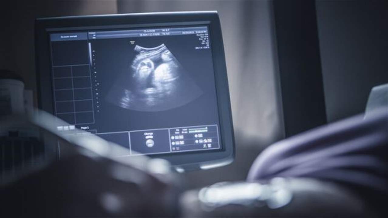 بالصورة - توفيت جراء حملها بـ"طفل متحجر" لأكثر من 50 عاماً