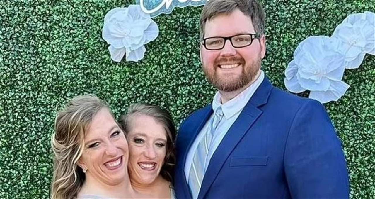 بالصور.. زواج التوأم الملتصق الأميركي الشهير