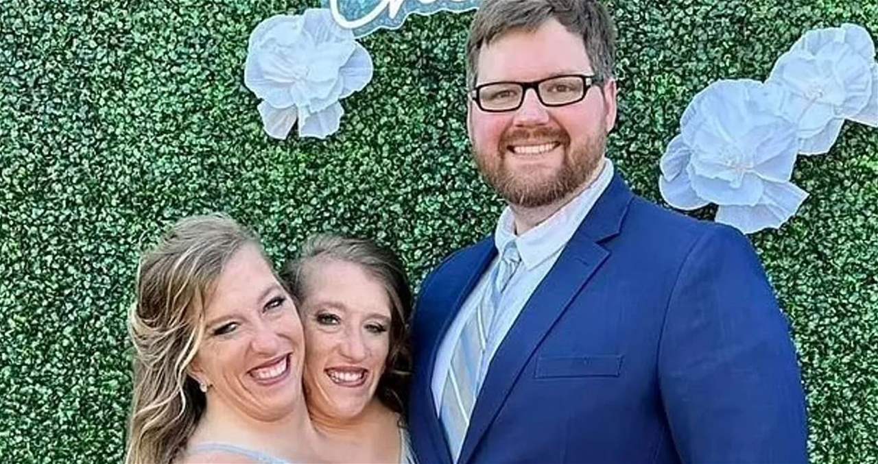 التوأم الملتصق آبي وبريتاني توجهان رسالة بعد ضجة "الزواج"