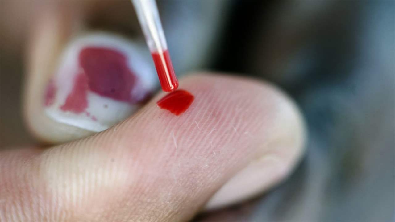 عصير لفقر الدم: سهل التحضير ومفيد! 