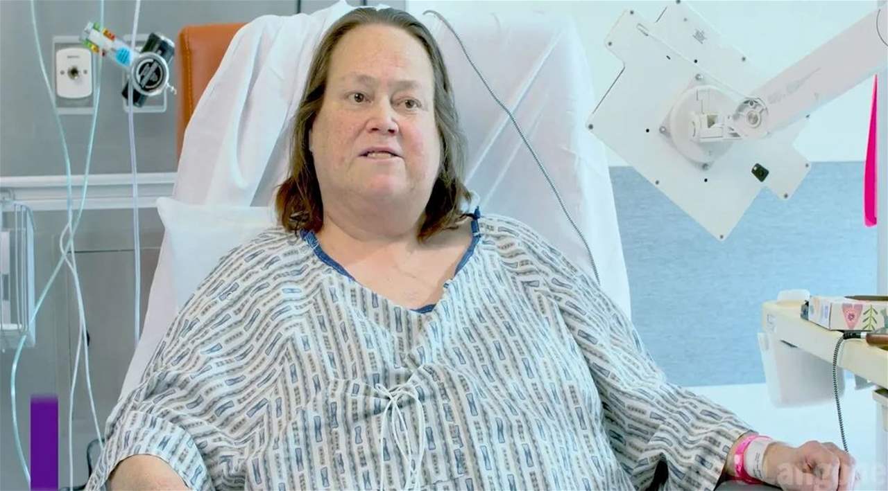 إنجاز طبي.. زرع كلية خنزير لمريض حي للمرة الثانية