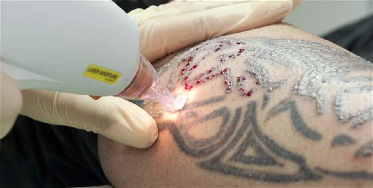 تحذير... الوشم قد يزيد خطر الإصابة بنوع نادر من السرطان!
