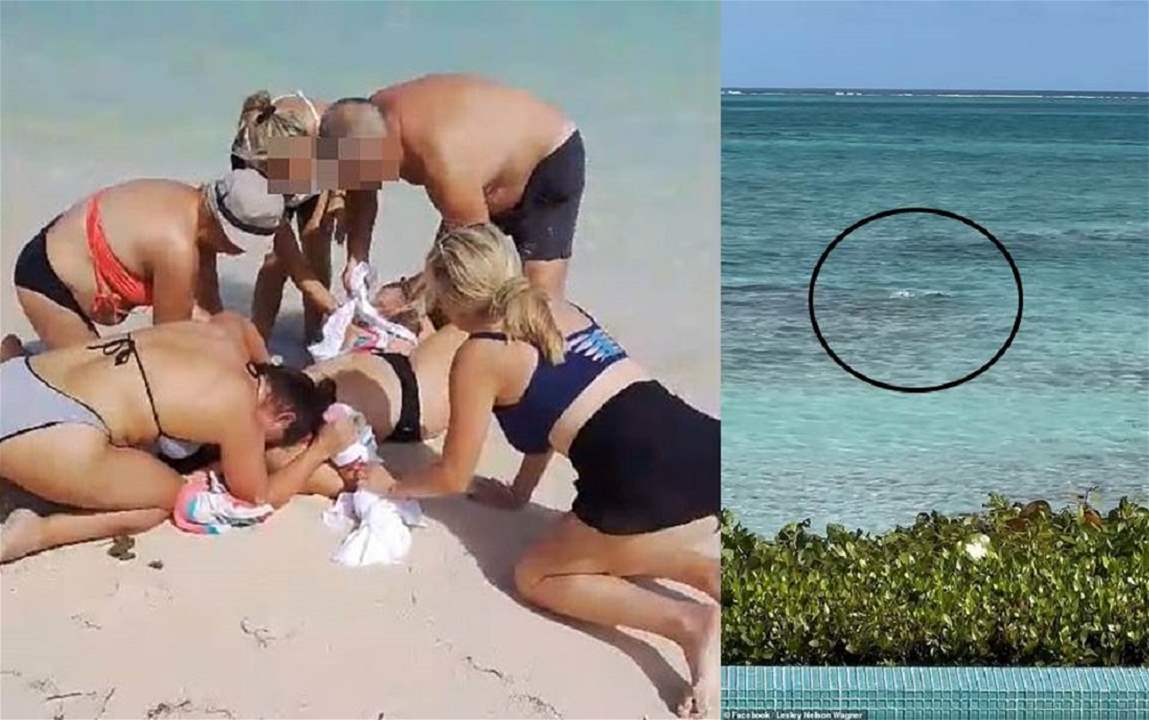 إمرأة تفقد ذراعيها في هجوم لسمكة قرش