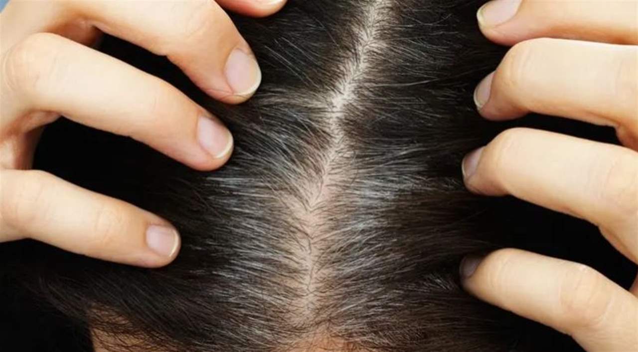 &quot;شيب الشعر&quot;.. كيف يتوقف؟ 