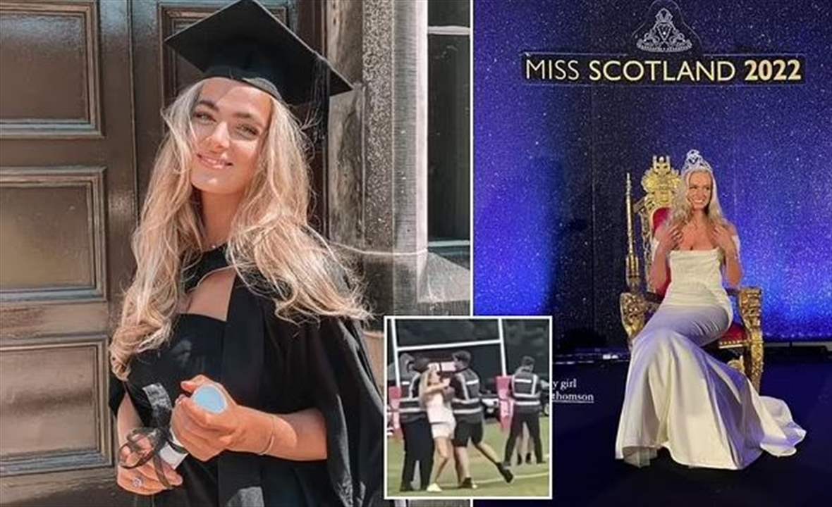 "عضّة" تجرّد ملكة جمال من لقبها! 