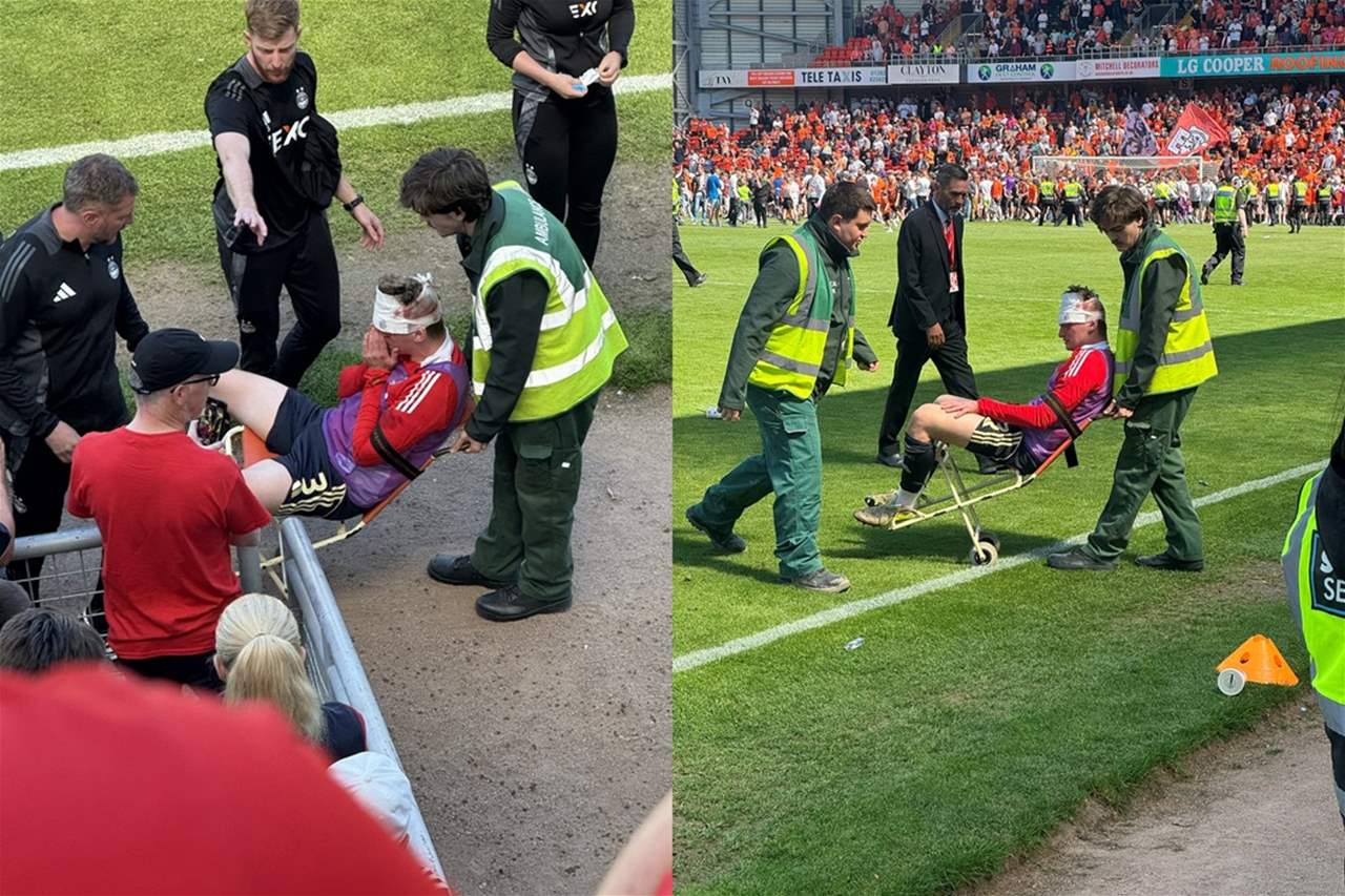 تلقى كرسي من المنصة تسبب بشق في رأسه !!