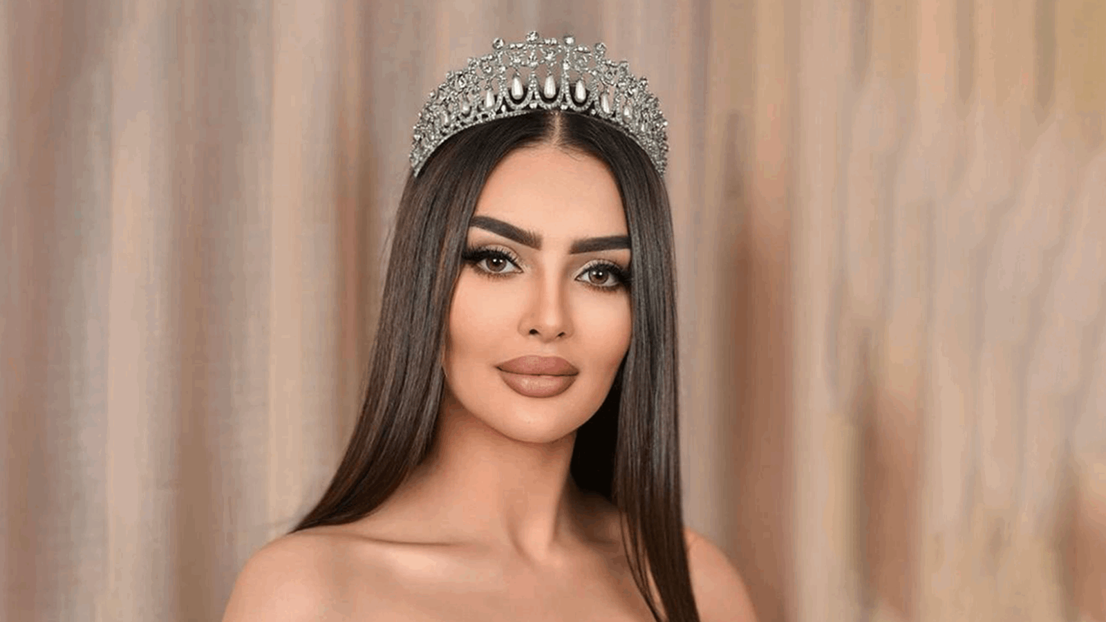 ملكة جمال السعودية رومي القحطاني تتعرض لتشوه في وجهها