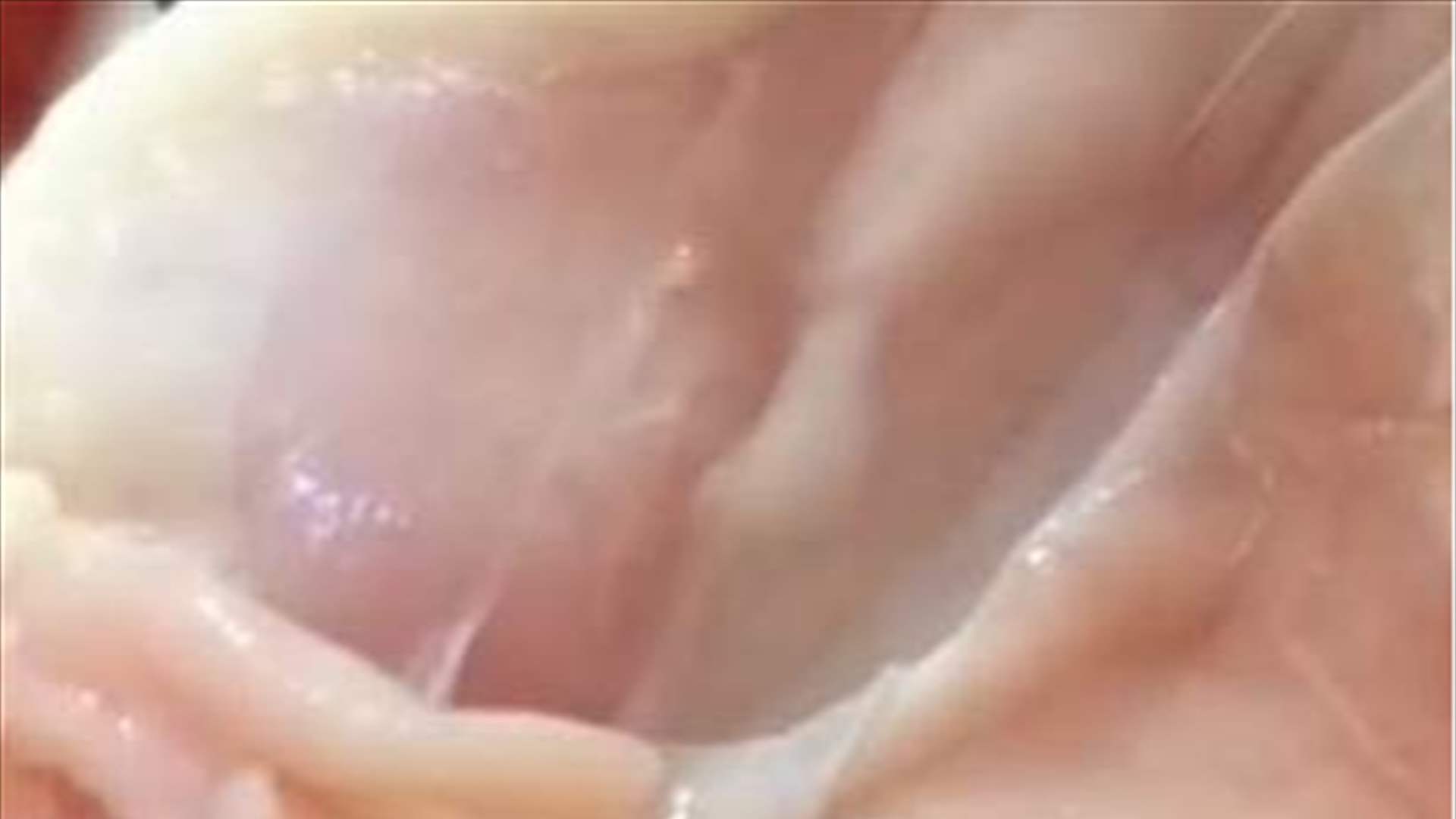 ديدان تغزو الدجاج