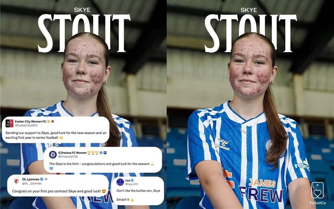 فيديو - حملة تنمّر على لاعبة شابة والسبب غريب ومعيب