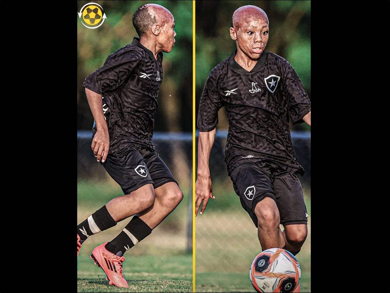 تحدّى المياه المغليّة والحروق وانضم الى بوتافوغو 