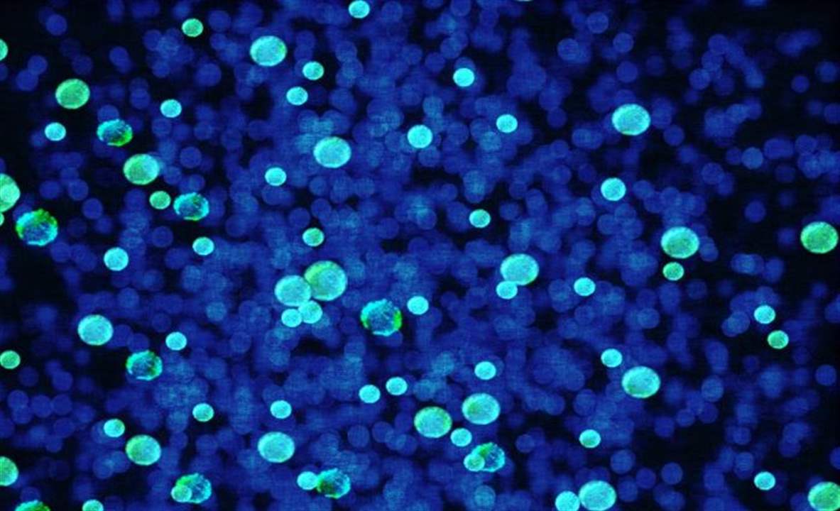  كائنات &quot;تتنفس&quot; الحديد بدلا من الأكسجين؟ 