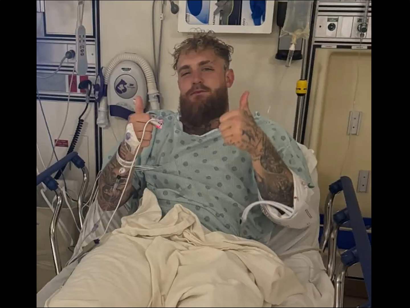 فيديو - جيك بول بعد هزيمته المدويّة: جراحة في الفك وأرقام مالية خيالية