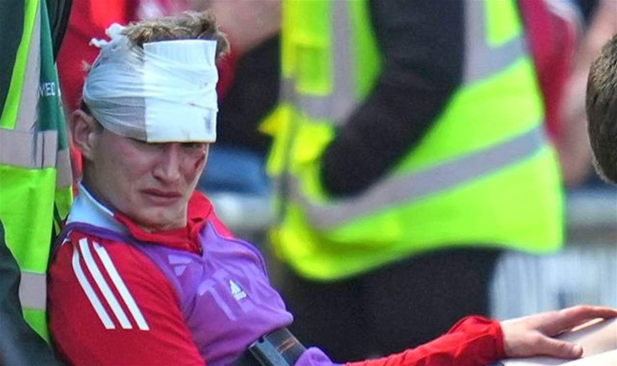 اعتدى على لاعب بكرسي: سجن وحظر لمشجع "أبردين"