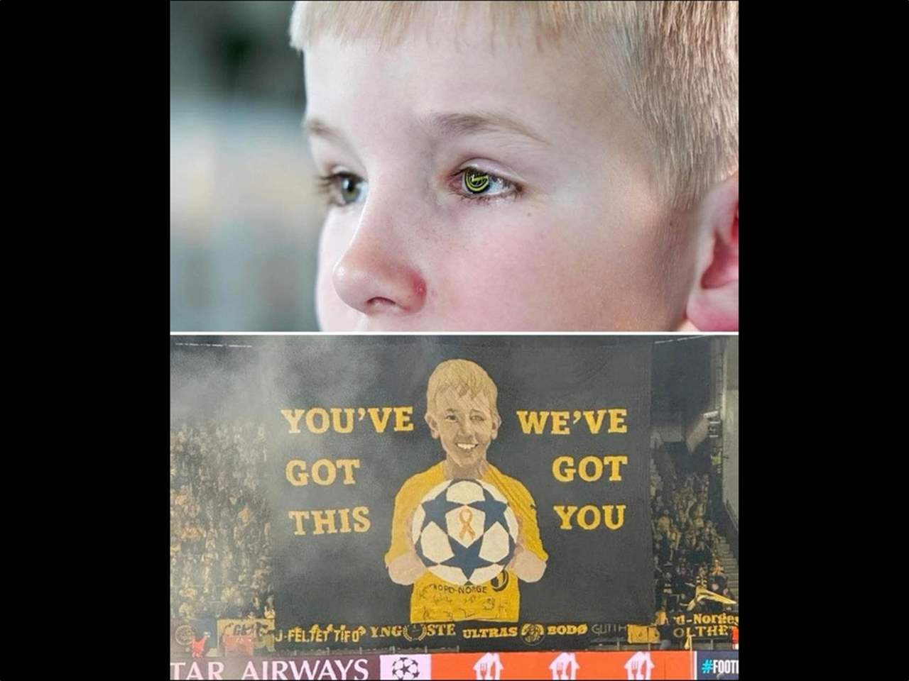 كيف كرّم بودو غليمت الطفل صاحب العين الزجاجية؟ 