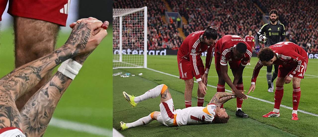 نوا لانغ يتعرّض لإصابة غريبة جداً في إصبع يده!!