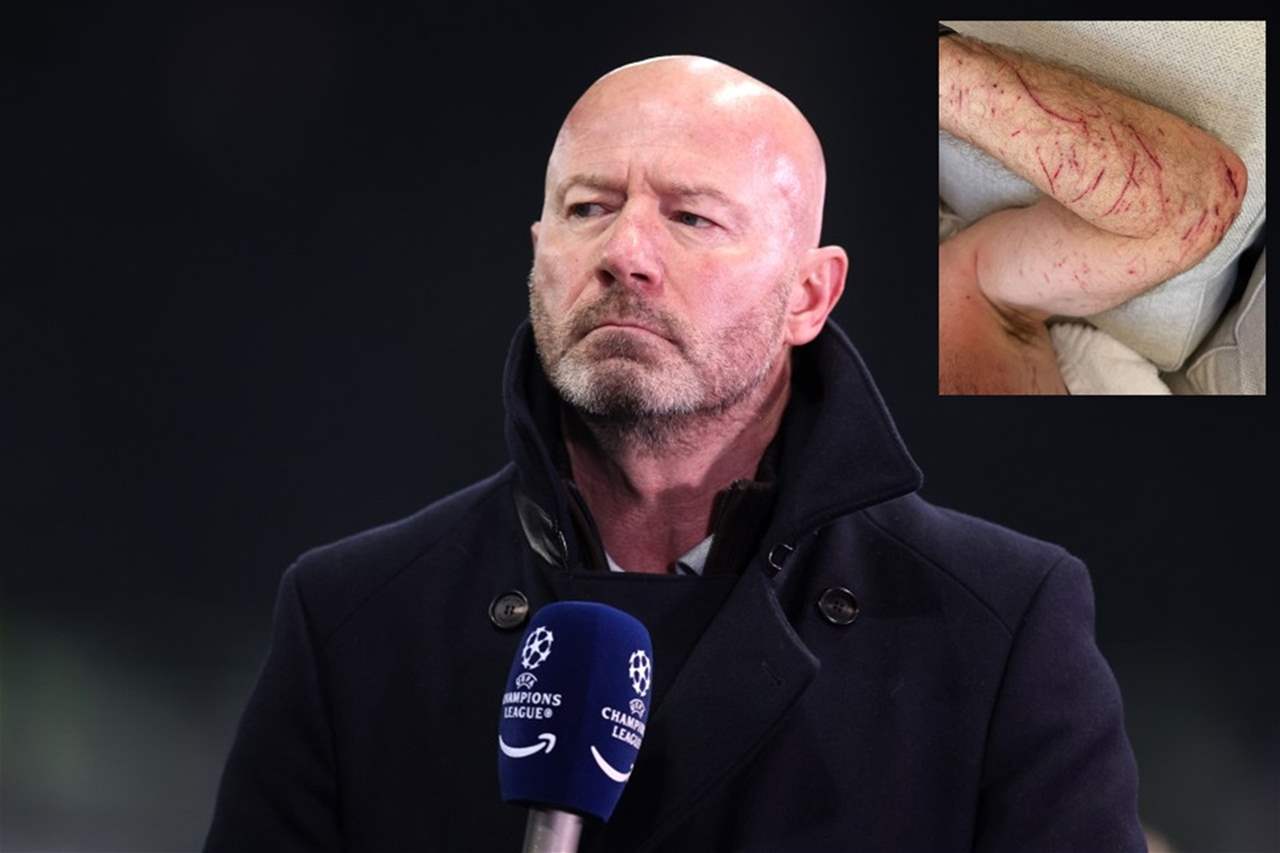 إصابة آلان شيرر بجروح بعد سقوطه عن دراجته