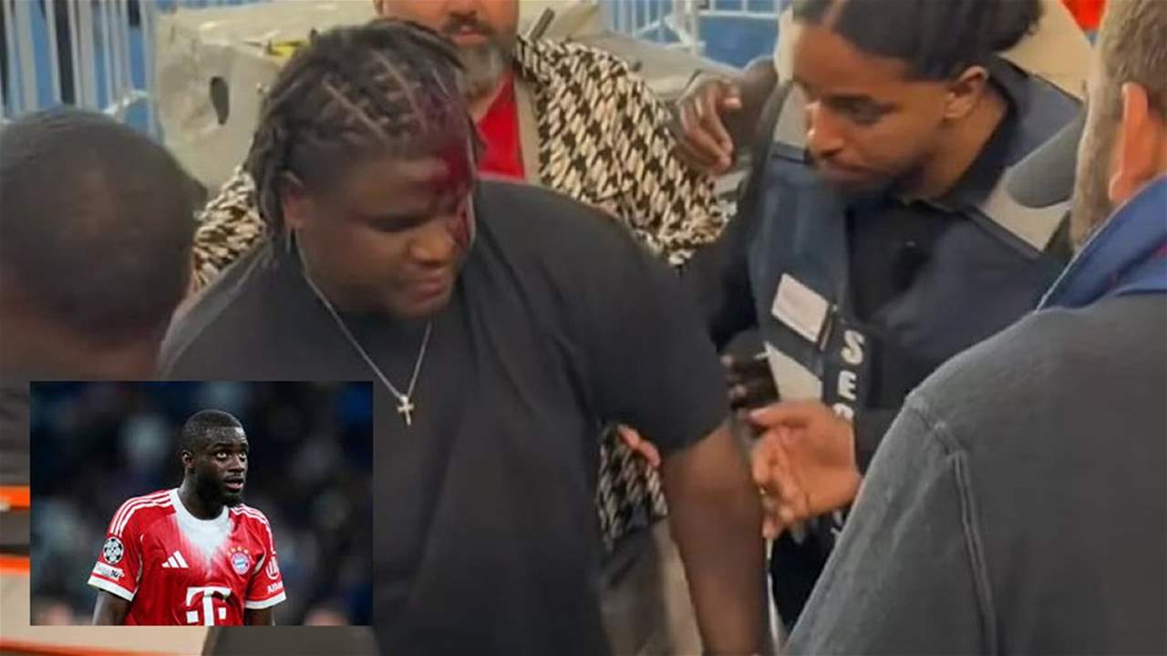 فيديو - زجاجة طائشة تصيب أحد ضيوف أوباميكانو 