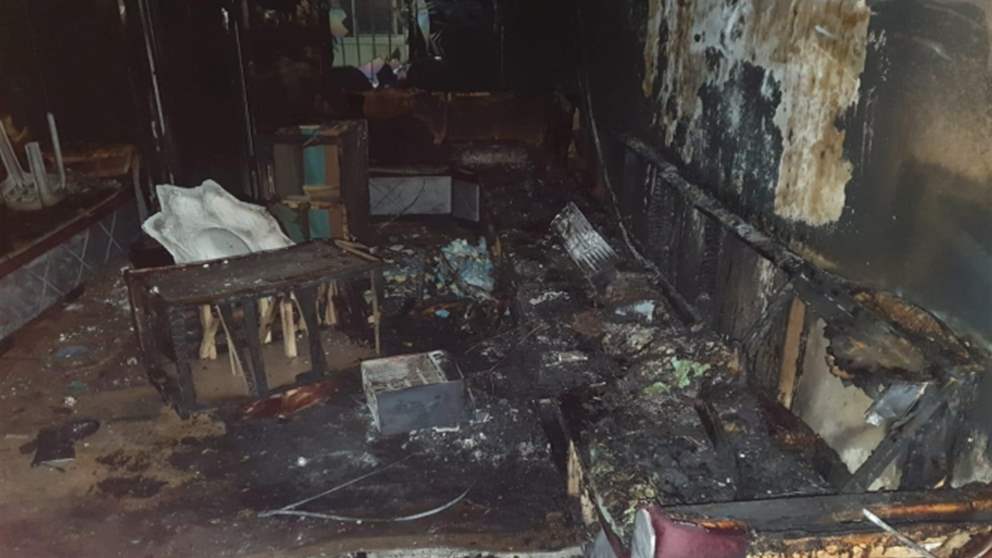 ممثل لبناني شهير يتعرض لحريق اثناء تواجده مع عائلته في المنزل وانتشار صورة له من المستشفى 