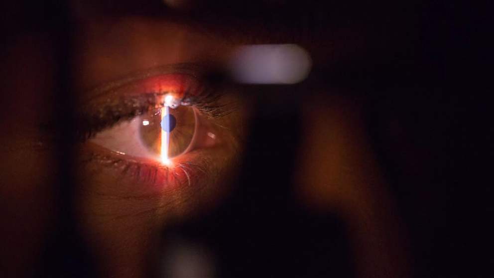  أطباء ينجحون بإجراء أول زراعة عين كاملة في العالم