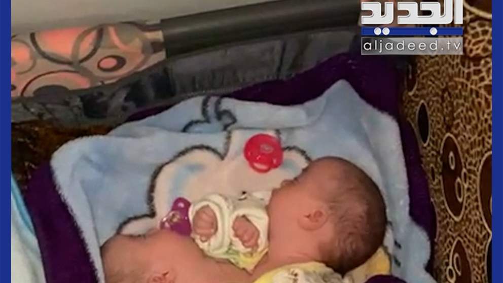 بالفيديو: ولادة توأم ملتصق في مستشفى رفيق الحريري