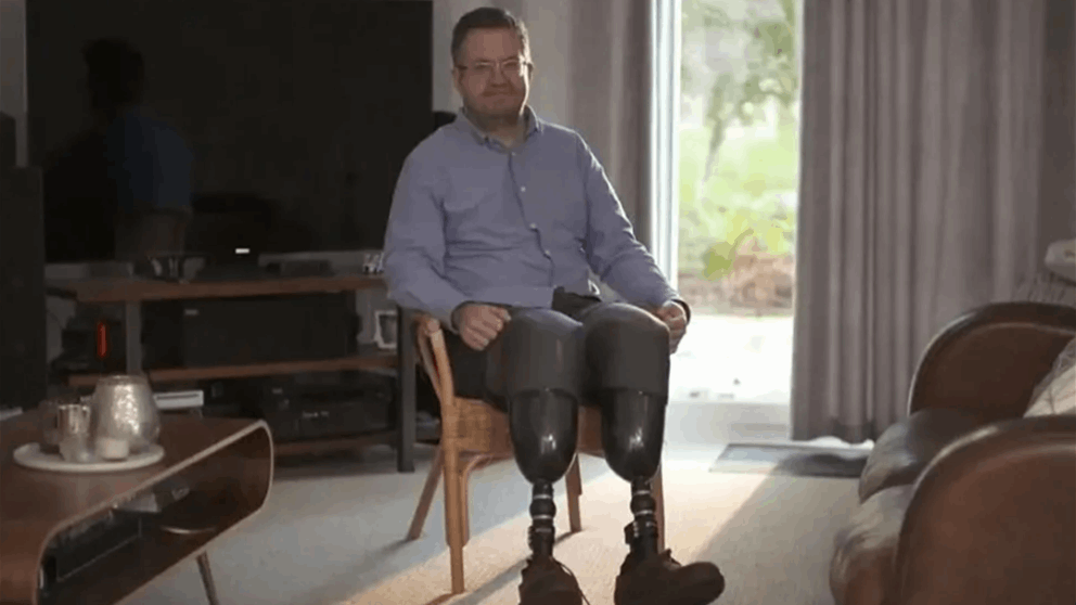 جراح بريطاني يبتر ساقيه عمداً.. والسبب صادم!