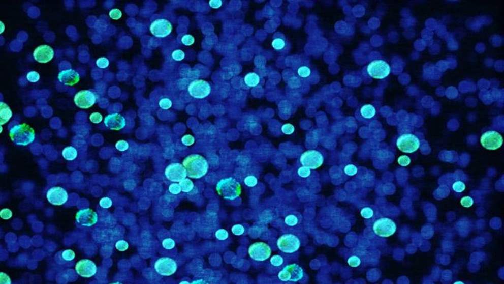  كائنات "تتنفس" الحديد بدلا من الأكسجين؟ 