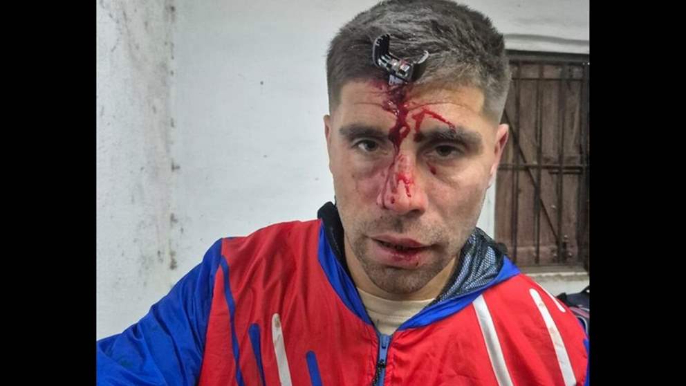 مفتاح السيارة استقر في جبين لاعب كرة قدم