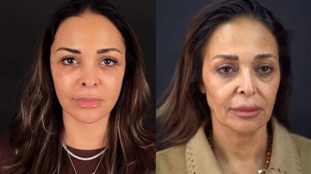 بعد شدّ الوجه والرقبة… داليا البحيري تتألق بإطلالة أصغر سنًا