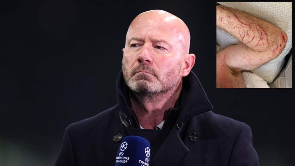 إصابة آلان شيرر بجروح بعد سقوطه عن دراجته