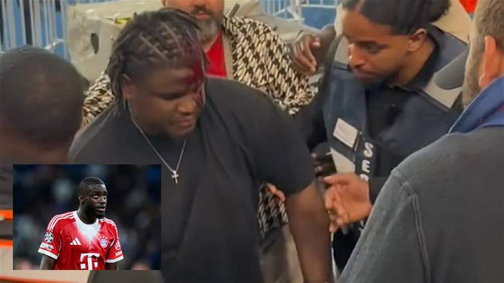 فيديو - زجاجة طائشة تصيب أحد ضيوف أوباميكانو 